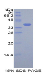 CSTA / Cystatin A Protein - Recombinant Cystatin A By SDS-PAGE