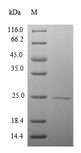CTDP1 / FCP1 Protein - (Tris-Glycine gel) Discontinuous SDS-PAGE (reduced) with 5% enrichment gel and 15% separation gel.