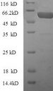 CTGF Protein - (Tris-Glycine gel) Discontinuous SDS-PAGE (reduced) with 5% enrichment gel and 15% separation gel.