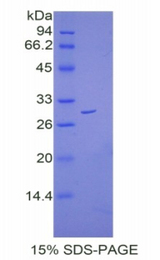 CTNNB1 / Beta Catenin Protein