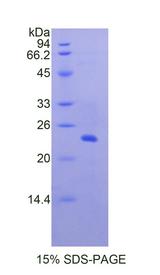 CTSB / Cathepsin B Protein - Recombinant Cathepsin B By SDS-PAGE