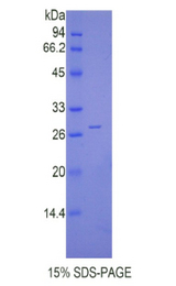CTSC / Cathepsin C / JP Protein - Recombinant Cathepsin C By SDS-PAGE