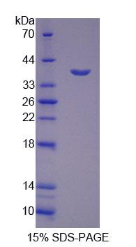 CTSH / Cathepsin H Protein - Recombinant Cathepsin H (CTSH) by SDS-PAGE