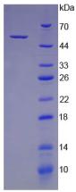 CTSK / Cathepsin K Protein - Recombinant Cathepsin K By SDS-PAGE