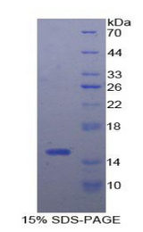 CXCL10 / IP-10 Protein - Recombinant Interferon Gamma Induced Protein 10kDa By SDS-PAGE