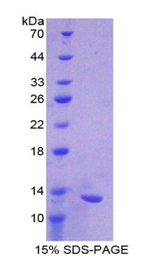 CXCL11 Protein - Recombinant Interferon Inducible T-Cell Alpha Chemoattractant By SDS-PAGE