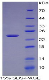 Cxcl15 Protein - Recombinant Chemokine C-X-C-Motif Ligand 15 By SDS-PAGE