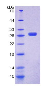 CXCL16 Protein - Recombinant Chemokine C-X-C-Motif Ligand 16 By SDS-PAGE