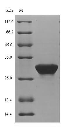 CXCL4 / PF4 Protein - (Tris-Glycine gel) Discontinuous SDS-PAGE (reduced) with 5% enrichment gel and 15% separation gel.
