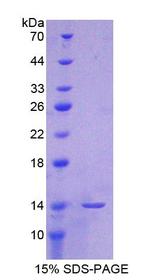 CXCL5 Protein - Recombinant  Epithelial Neutrophil Activating Peptide 78 By SDS-PAGE