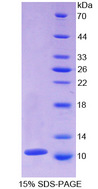 CXCL7 / PPBP Protein - Recombinant Beta-Thromboglobulin By SDS-PAGE