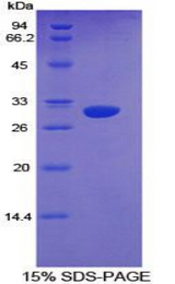 CYP1A1 Protein - Recombinant Cytochrome P450 1A1 By SDS-PAGE