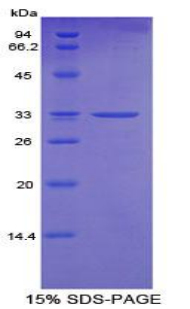 CYP24 / CYP24A1 Protein - Recombinant Cytochrome P450 24A1 By SDS-PAGE