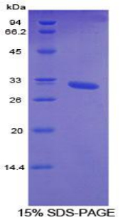 CYP26 / CYP26A1 Protein - Recombinant Cytochrome P450 26A1 By SDS-PAGE
