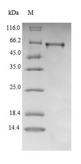 CYP27B1 Protein - (Tris-Glycine gel) Discontinuous SDS-PAGE (reduced) with 5% enrichment gel and 15% separation gel.