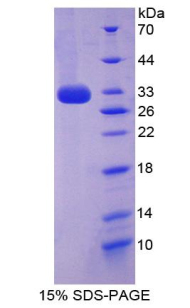 CYP27B1 Protein - Recombinant Cytochrome P450 27B1 By SDS-PAGE