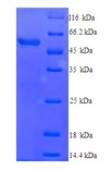 CYP2E1 Protein