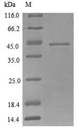 CYR61 Protein - (Tris-Glycine gel) Discontinuous SDS-PAGE (reduced) with 5% enrichment gel and 15% separation gel.