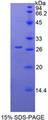 CYR61 Protein - Recombinant Cysteine Rich Protein, Angiogenic Inducer 61 By SDS-PAGE