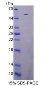 DAPK3 / ZIP Kinase Protein - Recombinant Death Associated Protein Kinase 3 By SDS-PAGE
