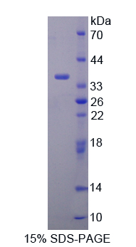 DAPP1 / BAM32 Protein - Recombinant  Dual Adaptor Of Phosphotyrosine And 3-Phosphoinositides By SDS-PAGE
