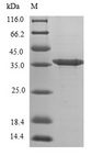 DCN / Decorin Protein - (Tris-Glycine gel) Discontinuous SDS-PAGE (reduced) with 5% enrichment gel and 15% separation gel.