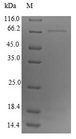 DCT / Dopachrome Tautomerase Protein - (Tris-Glycine gel) Discontinuous SDS-PAGE (reduced) with 5% enrichment gel and 15% separation gel.