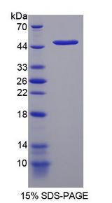 DDIT3 / CHOP Protein - Recombinant DNA Damage Inducible Transcript 3 By SDS-PAGE