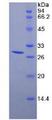 DDX58 / RIG-1 / RIG-I Protein - Recombinant Retinoic Acid Inducible Gene 1 Protein By SDS-PAGE