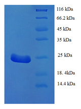 DEC-205 / CD205 / LY75 Protein