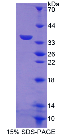 DEC-205 / CD205 / LY75 Protein - Recombinant  Lymphocyte Antigen 75 By SDS-PAGE
