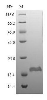 DEFB1 / BD-1 Protein - (Tris-Glycine gel) Discontinuous SDS-PAGE (reduced) with 5% enrichment gel and 15% separation gel.