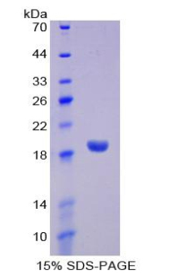 DeltaSIP Protein - Recombinant Delta-Sleep Inducing Peptide By SDS-PAGE