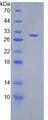 DGKA Protein - Recombinant Diacylglycerol Kinase Alpha By SDS-PAGE