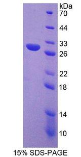DGKG Protein - Recombinant  Diacylglycerol Kinase Gamma By SDS-PAGE