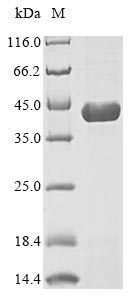 DHODH Protein - (Tris-Glycine gel) Discontinuous SDS-PAGE (reduced) with 5% enrichment gel and 15% separation gel.