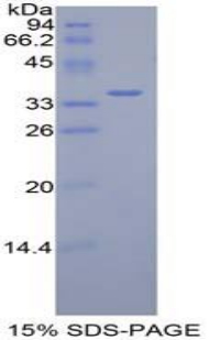DISPA / DISP1 Protein - Recombinant Dispatched Homolog 1 By SDS-PAGE