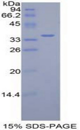 DISPA / DISP1 Protein - Recombinant Dispatched Homolog 1 By SDS-PAGE