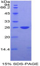 DIXDC1 Protein - Recombinant DIX Domain Containing Protein 1 By SDS-PAGE