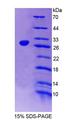 DKC1 / Dyskerin Protein - Recombinant Dyskerin By SDS-PAGE