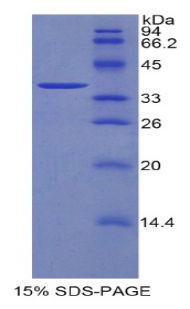 DKK4 Protein - Recombinant Dickkopf Related Protein 4 By SDS-PAGE