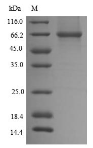 DLAT / PDC-E2 Protein - (Tris-Glycine gel) Discontinuous SDS-PAGE (reduced) with 5% enrichment gel and 15% separation gel.
