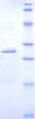 DLAT / PDC-E2 Protein
