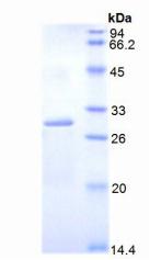 DLAT / PDC-E2 Protein - Recombinant Dihydrolipoyl Transacetylase By SDS-PAGE