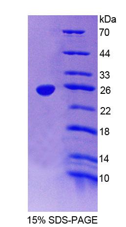 DLG5 Protein - Recombinant Discs, Large Homolog 5 (DLG5) by SDS-PAGE