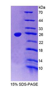 DLG5 Protein - Recombinant Discs, Large Homolog 5 (DLG5) by SDS-PAGE