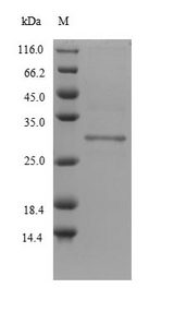 DLK2 Protein - (Tris-Glycine gel) Discontinuous SDS-PAGE (reduced) with 5% enrichment gel and 15% separation gel.