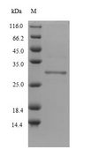 DLK2 Protein - (Tris-Glycine gel) Discontinuous SDS-PAGE (reduced) with 5% enrichment gel and 15% separation gel.