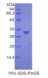 DMD / Dystrophin Protein - Recombinant Dystrophin By SDS-PAGE