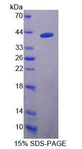 DNAJB1 / Hsp40 Protein - Recombinant  Heat Shock Protein 40 By SDS-PAGE